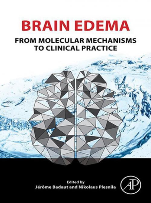 Cover of the book Brain Edema by , Elsevier Science