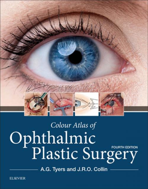 Cover of the book Colour Atlas of Ophthalmic Plastic Surgery E-Book by Anthony G. Tyers, FRCS(Eng), FRCS(Ed), FRCOphth, J. R. O. Collin, MA, MB, Bchir, FRCS, FRCOphth, DO, Elsevier Health Sciences