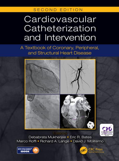 Cover of the book Cardiovascular Catheterization and Intervention by , CRC Press