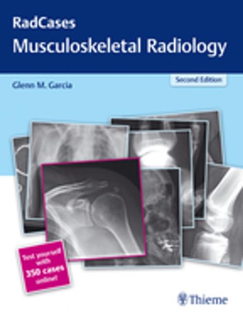 Cover of the book Radcases Musculoskeletal Radiology by , Thieme