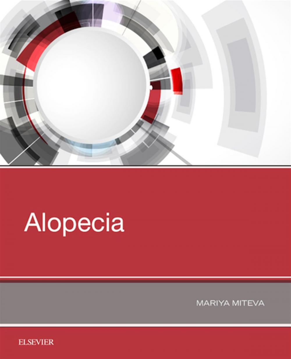 Big bigCover of Alopecia