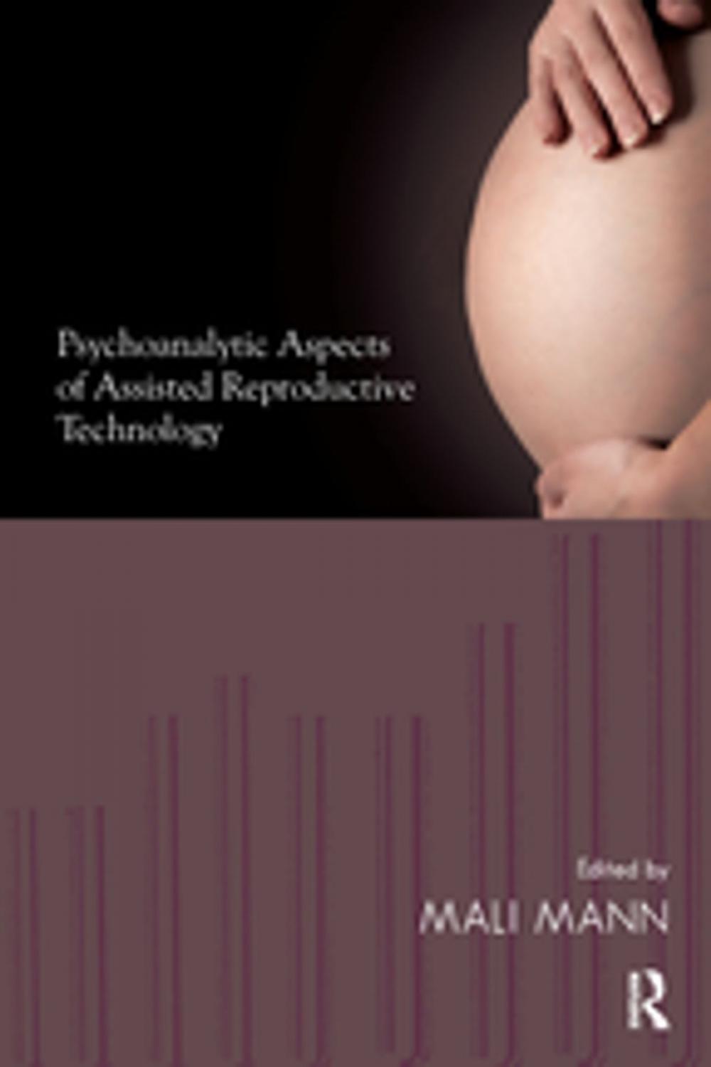 Big bigCover of Psychoanalytic Aspects of Assisted Reproductive Technology