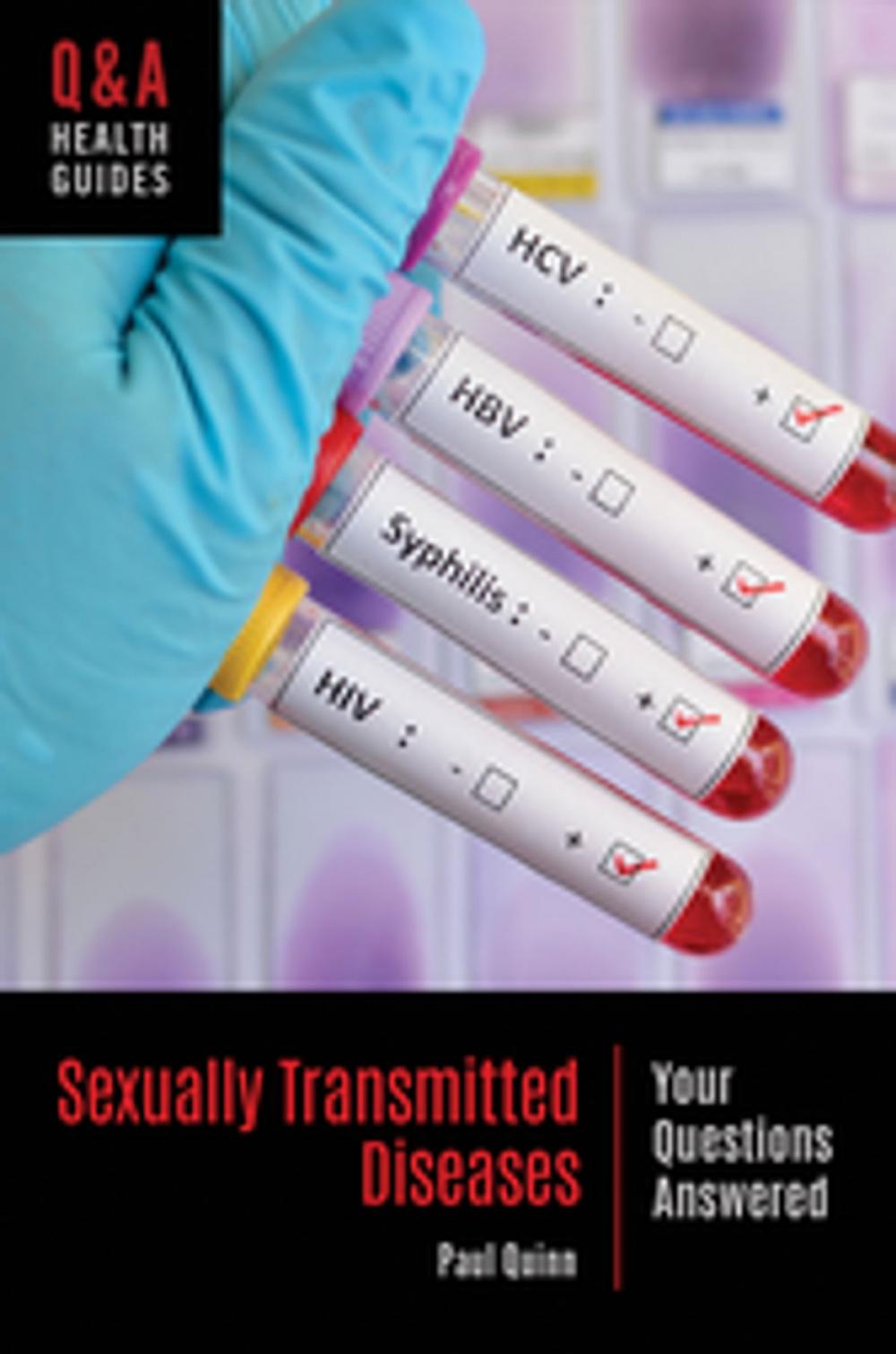 Big bigCover of Sexually Transmitted Diseases: Your Questions Answered