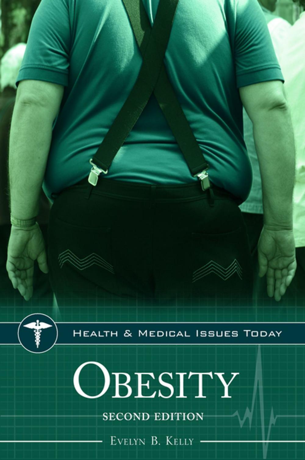 Big bigCover of Obesity, 2nd Edition