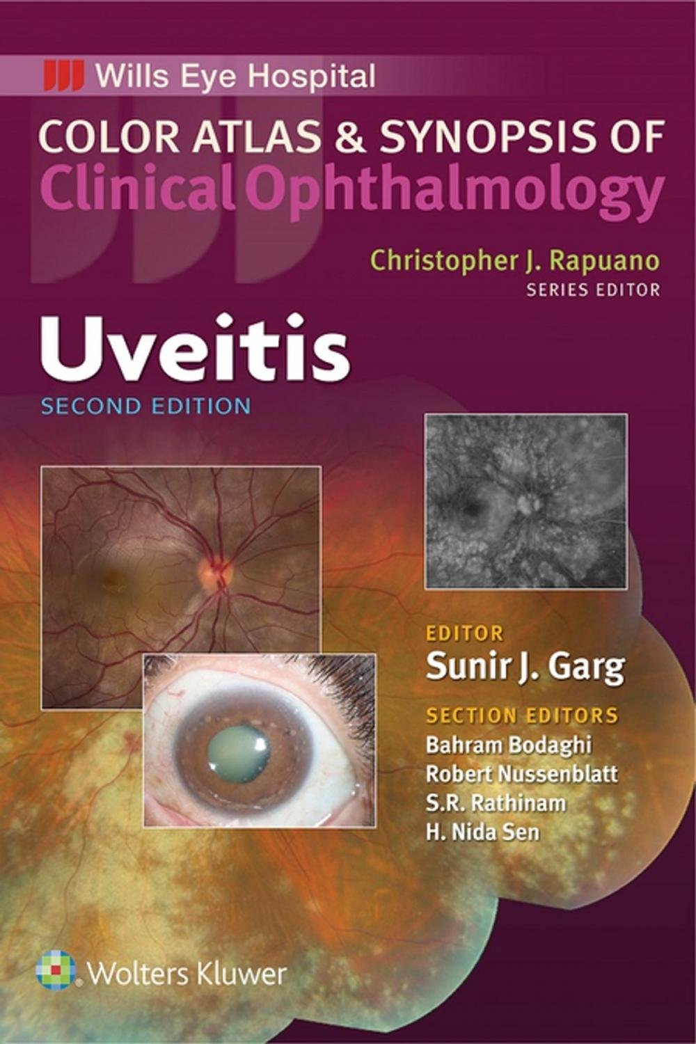 Big bigCover of Uveitis