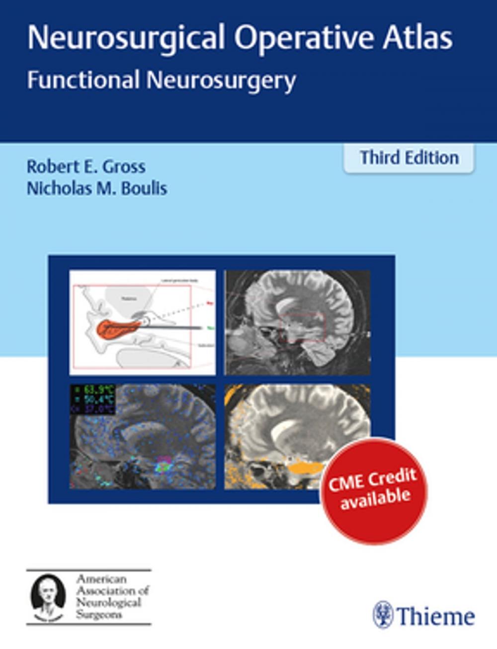 Big bigCover of Neurosurgical Operative Atlas: Functional Neurosurgery