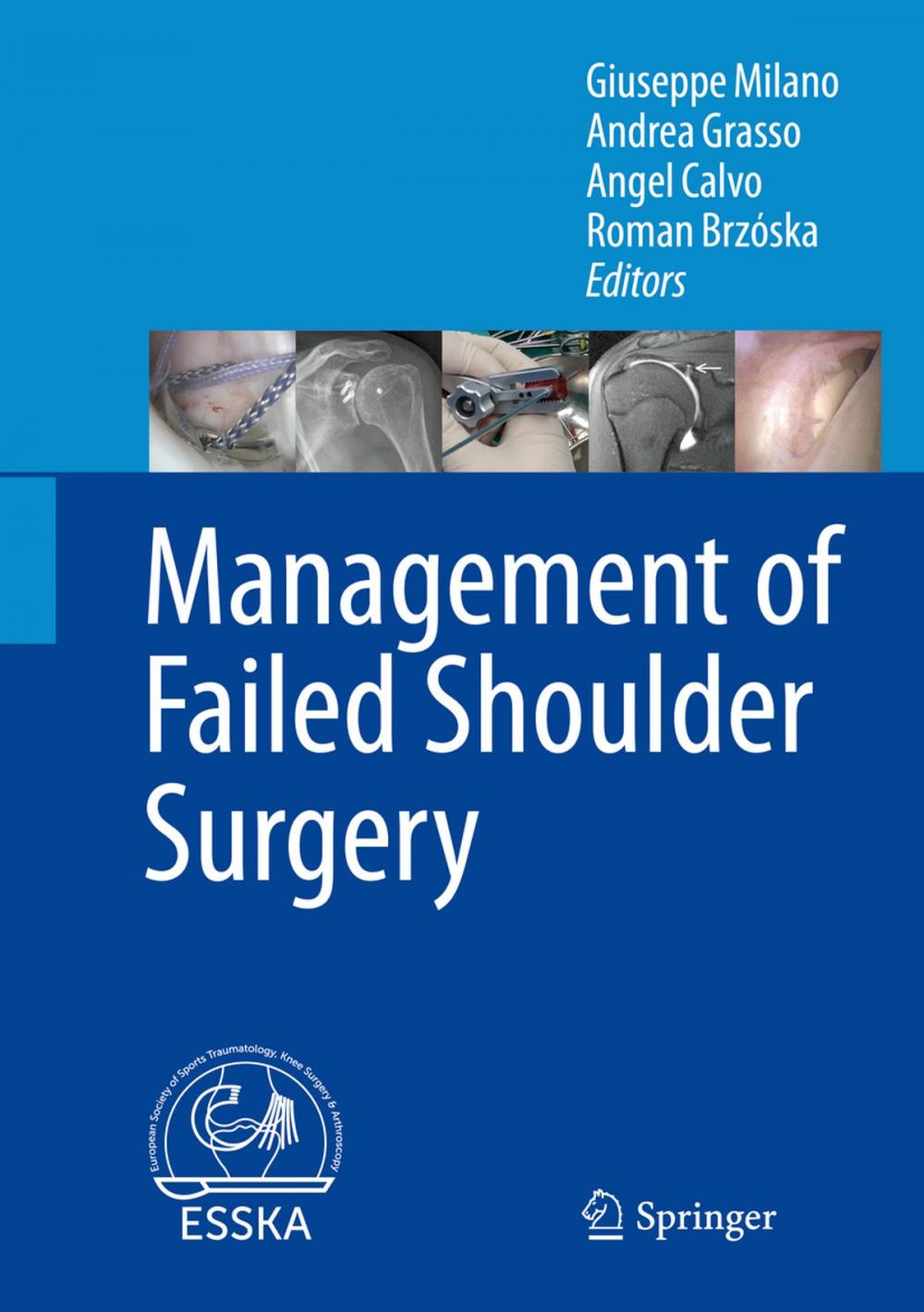 Big bigCover of Management of Failed Shoulder Surgery