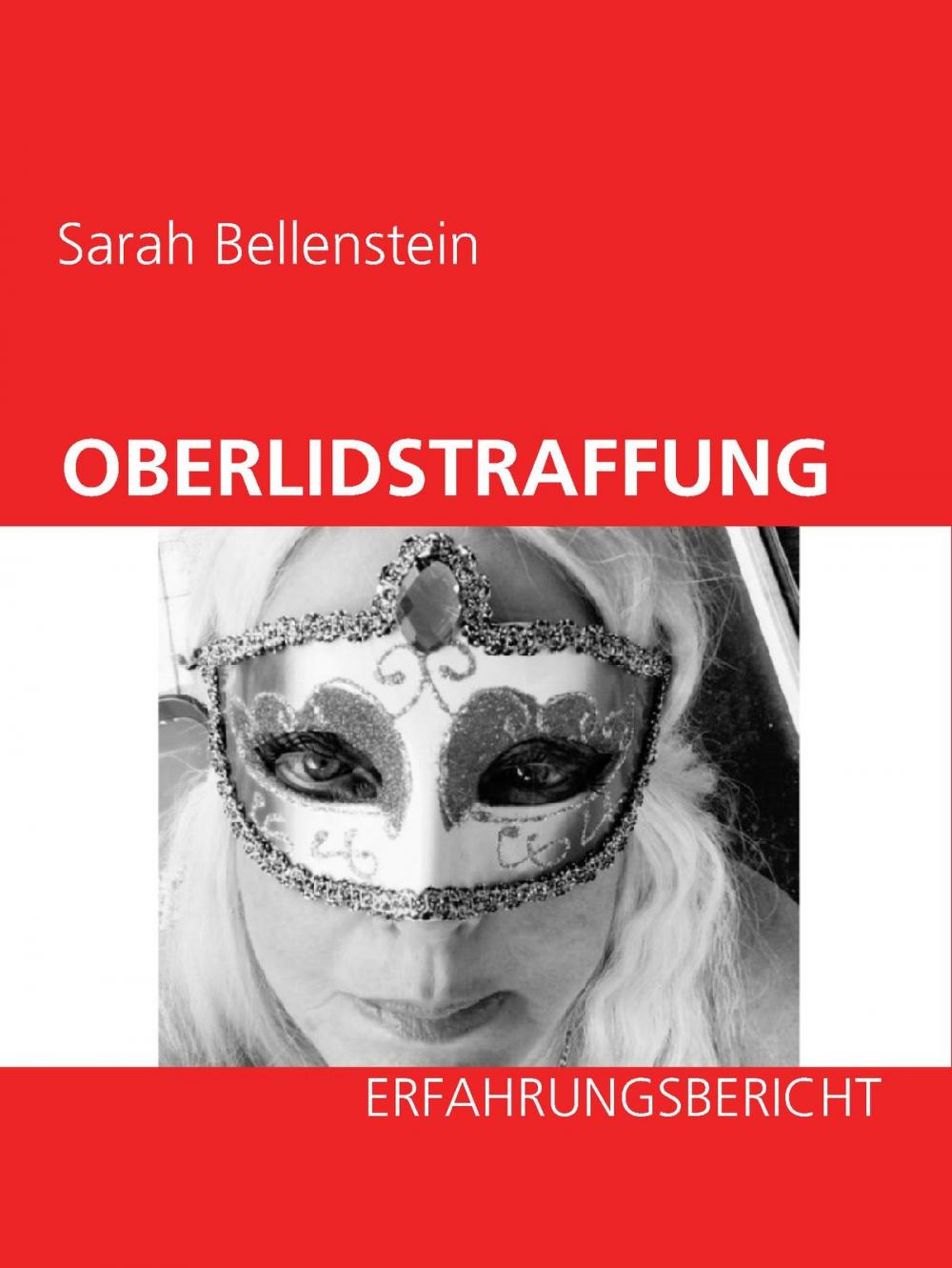 Big bigCover of Oberlidstraffung - Erfahrungsbericht