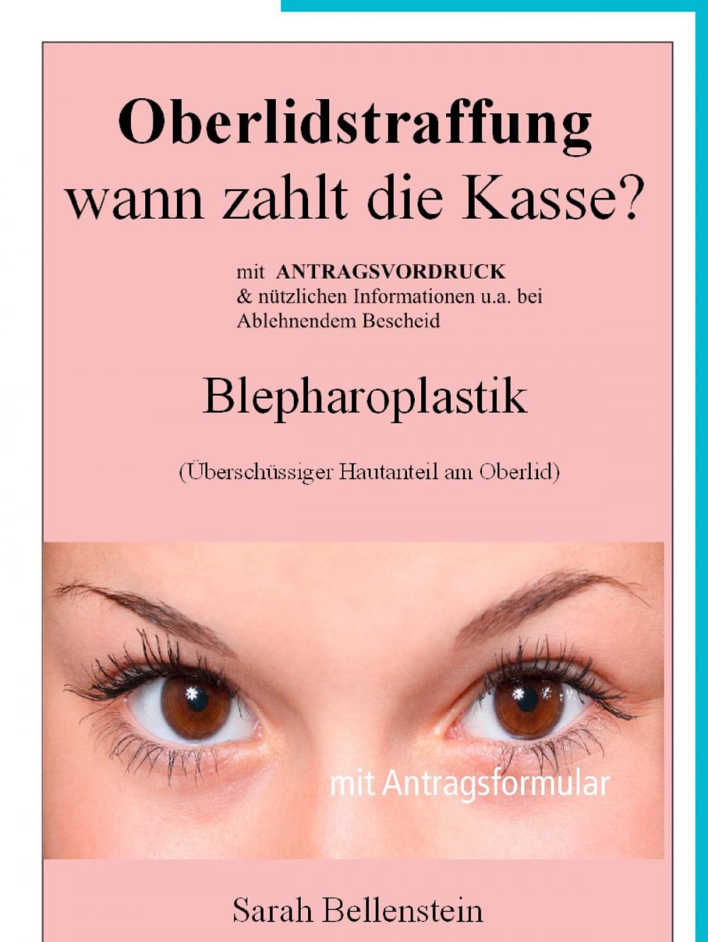 Big bigCover of Oberlidstraffung - Wann zahlt die Kasse?