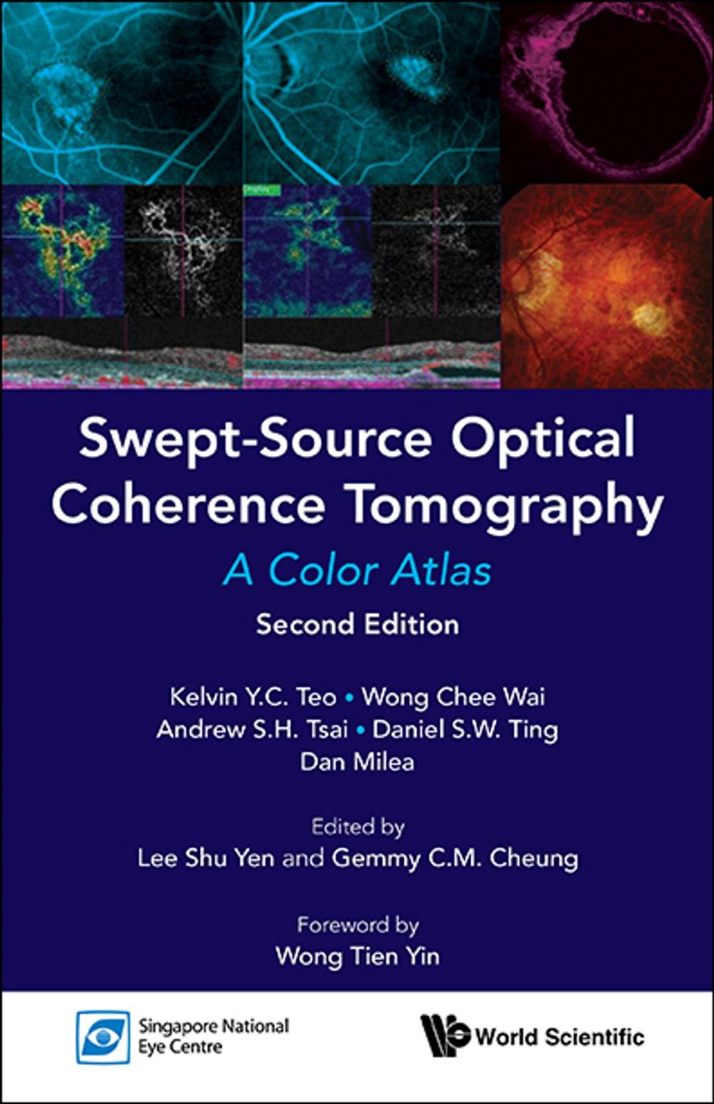 Big bigCover of Swept-Source Optical Coherence Tomography