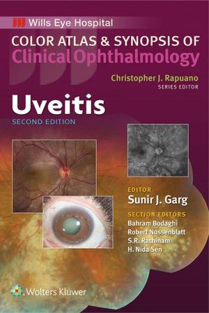 Book cover of Uveitis