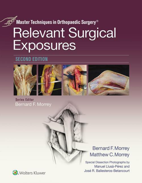 Cover of the book Master Techniques in Orthopaedic Surgery: Relevant Surgical Exposures by Bernard F. Morrey, Wolters Kluwer Health