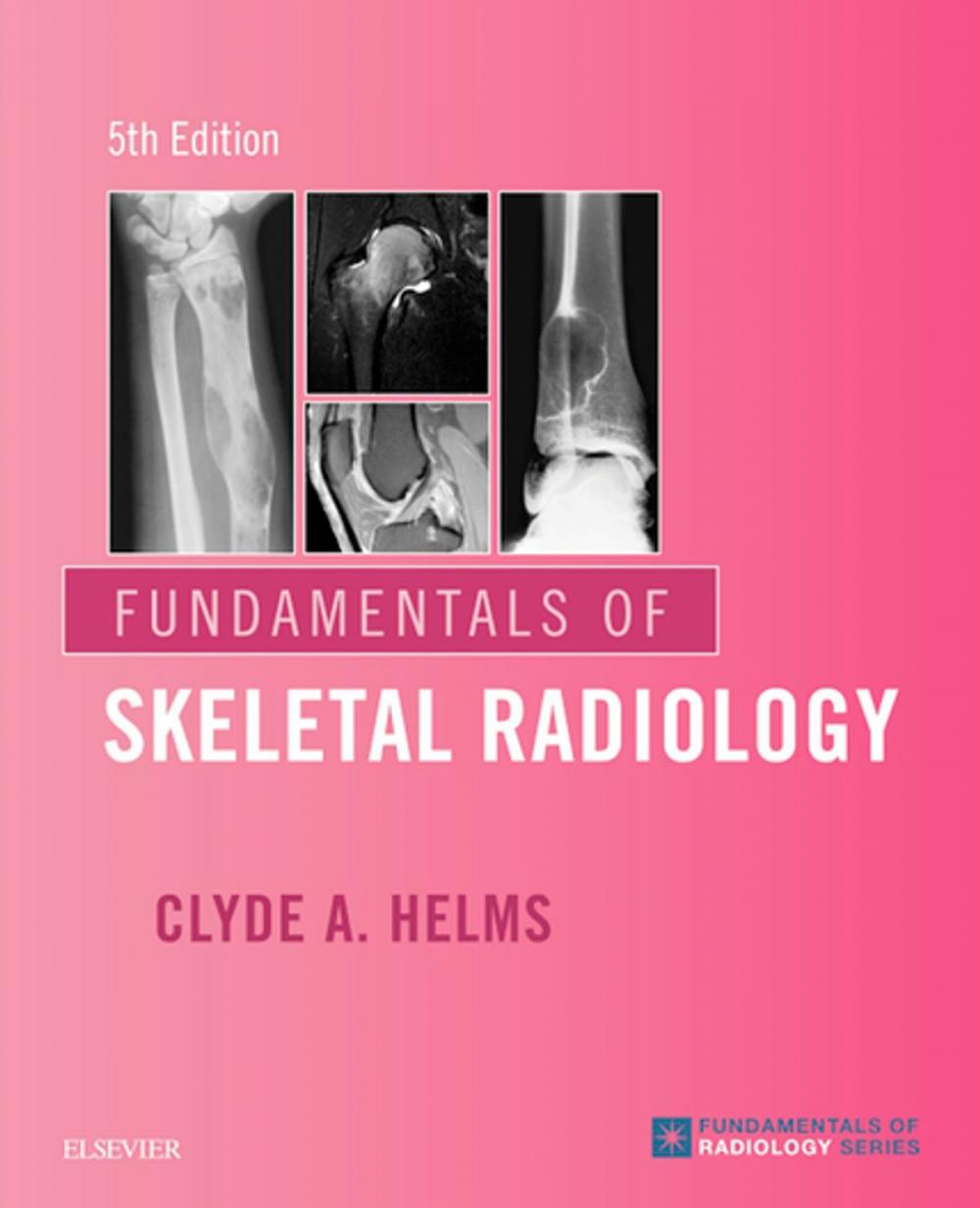 Big bigCover of Fundamentals of Skeletal Radiology E-Book