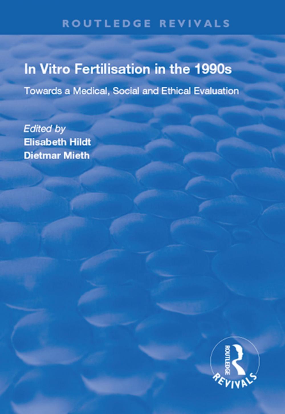 Big bigCover of In Vitro Fertilisation in the 1990s