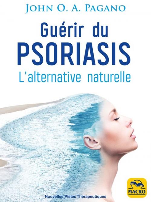 Cover of the book Guérir du psoriasis by John Pagano, Macro Editions