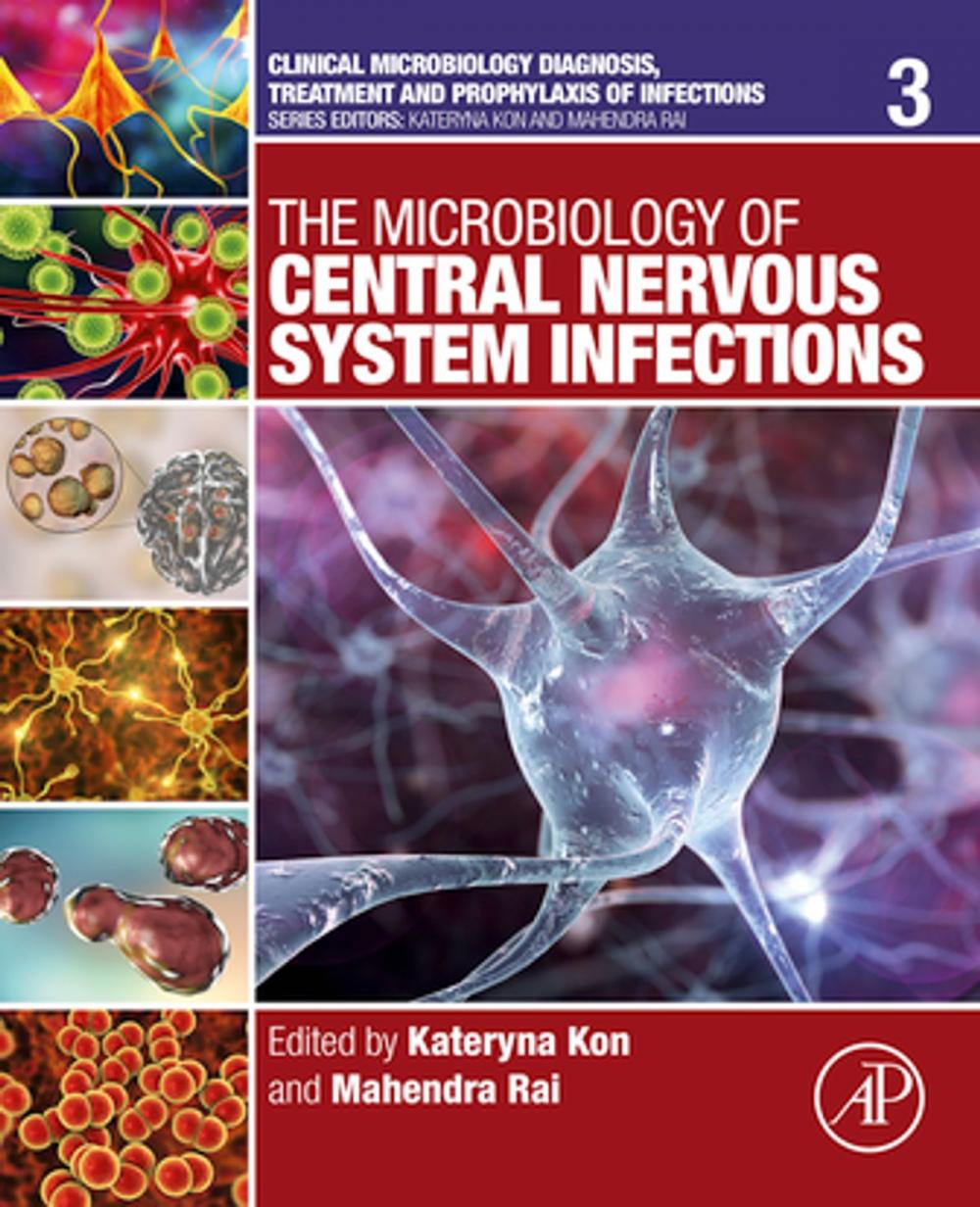 Big bigCover of The Microbiology of Central Nervous System Infections