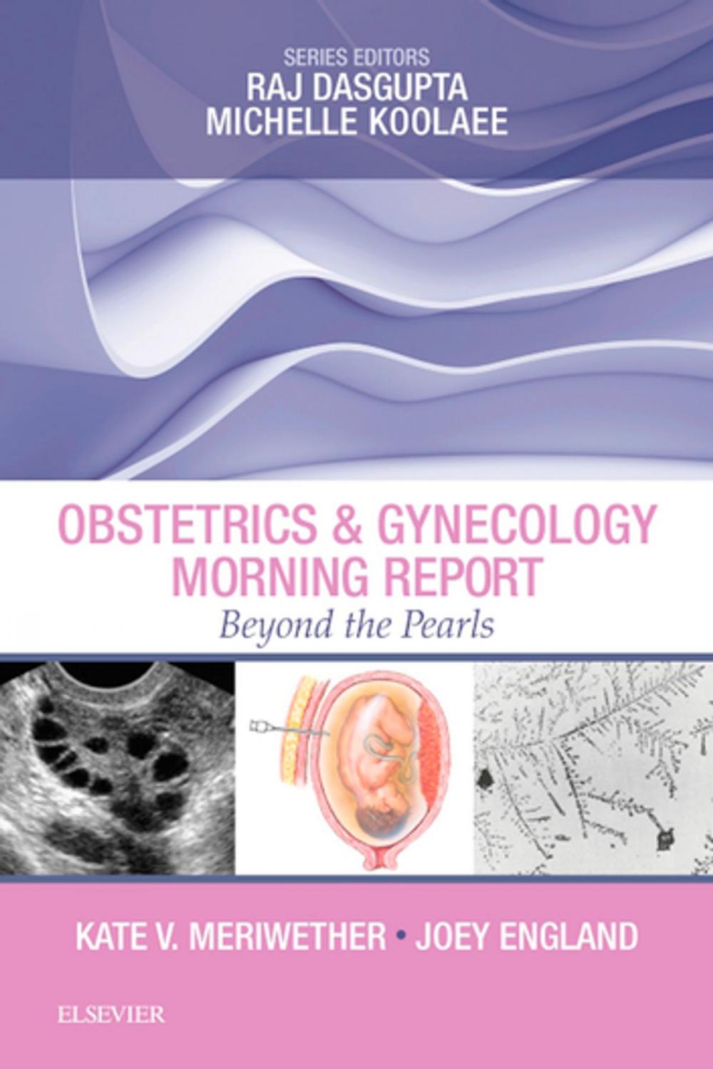 Big bigCover of Obstetrics & Gynecology Morning Report: Beyond the Pearls E-Book