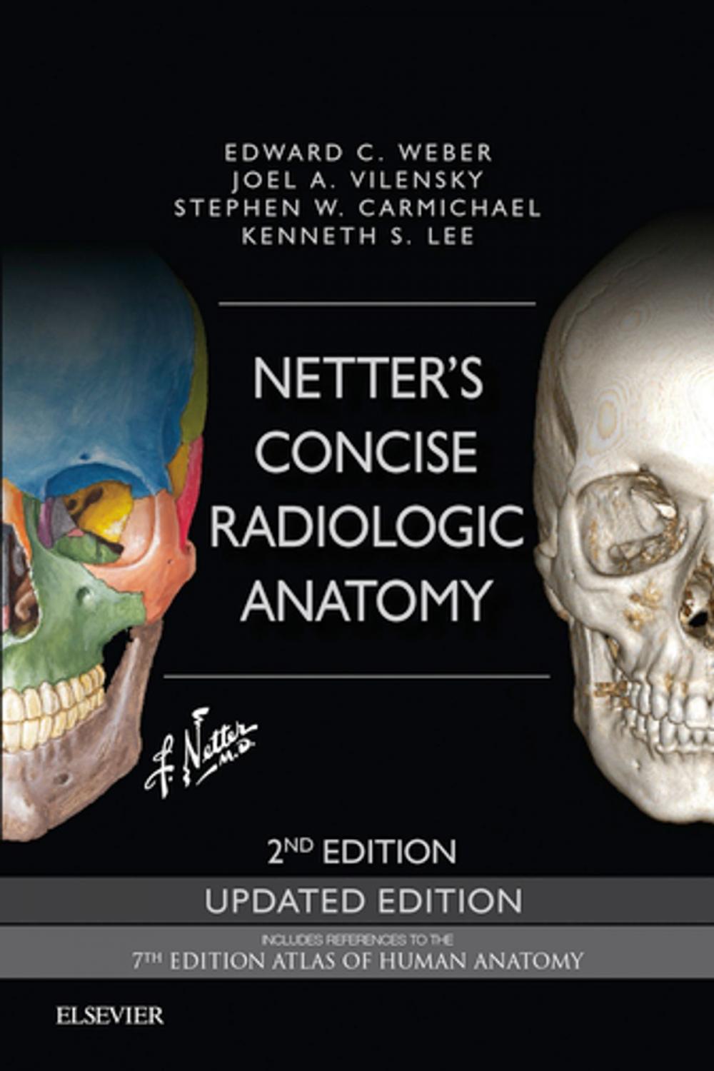 Big bigCover of Netter's Concise Radiologic Anatomy Updated Edition E-Book