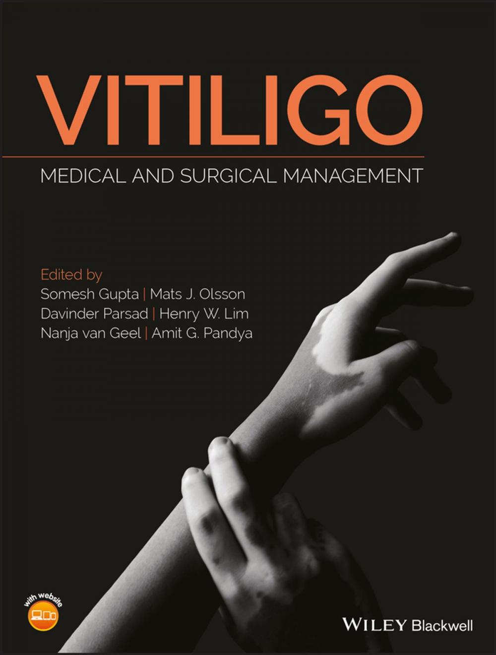 Big bigCover of Vitiligo