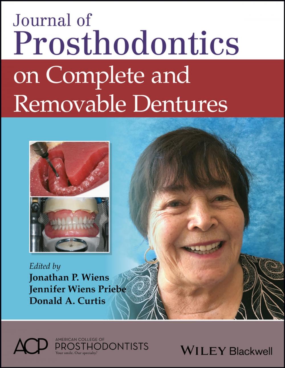 Big bigCover of Journal of Prosthodontics on Complete and Removable Dentures