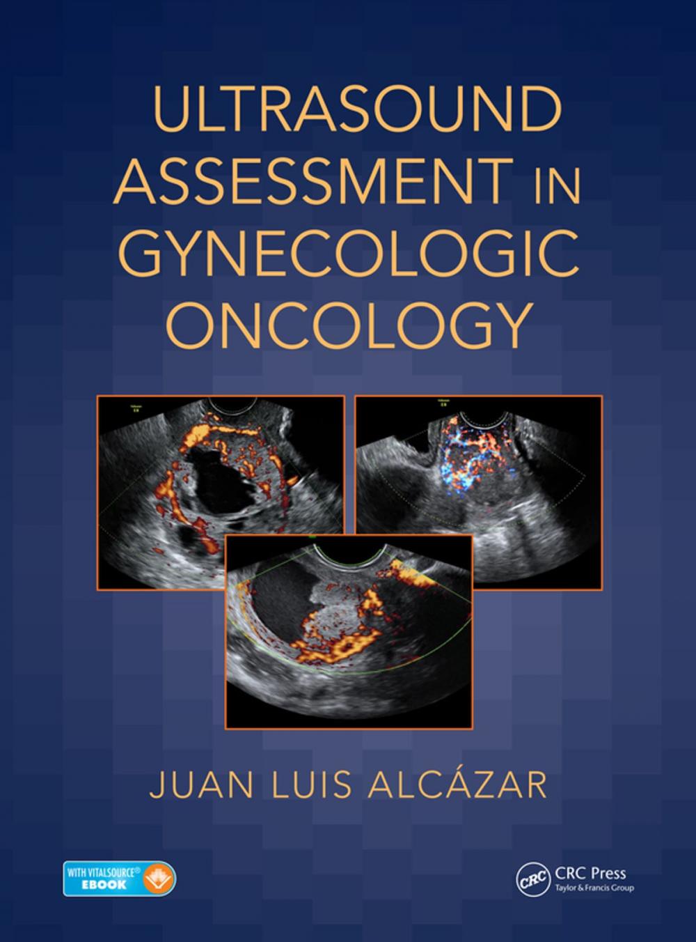 Big bigCover of Ultrasound Assessment in Gynecologic Oncology