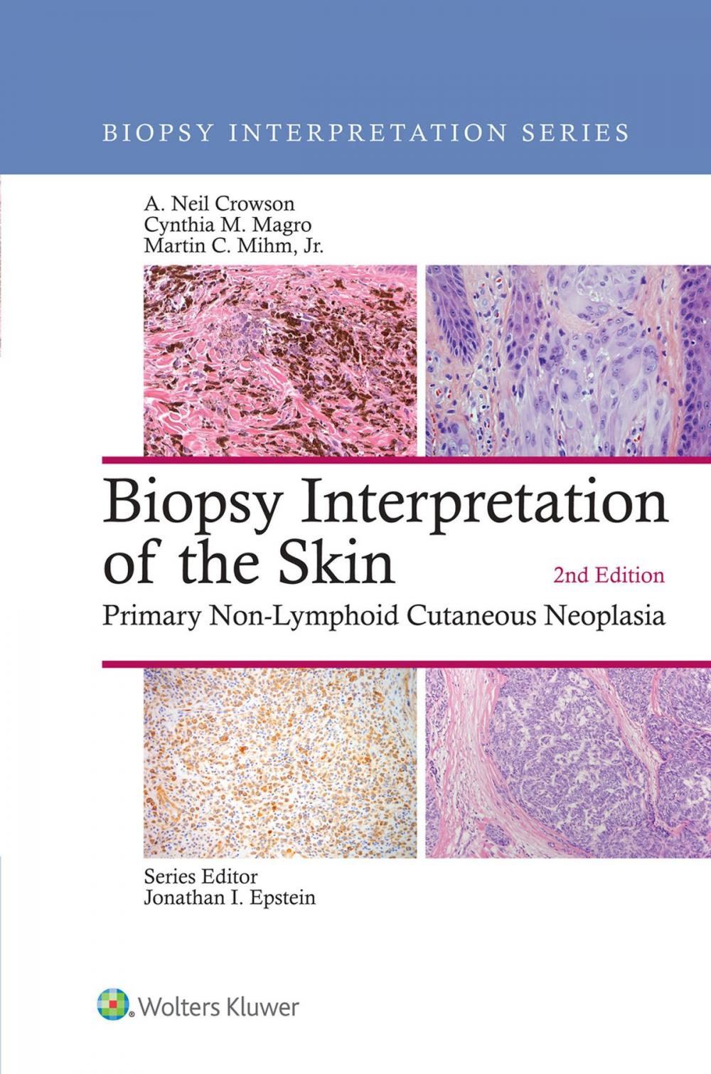 Big bigCover of Biopsy Interpretation of the Skin