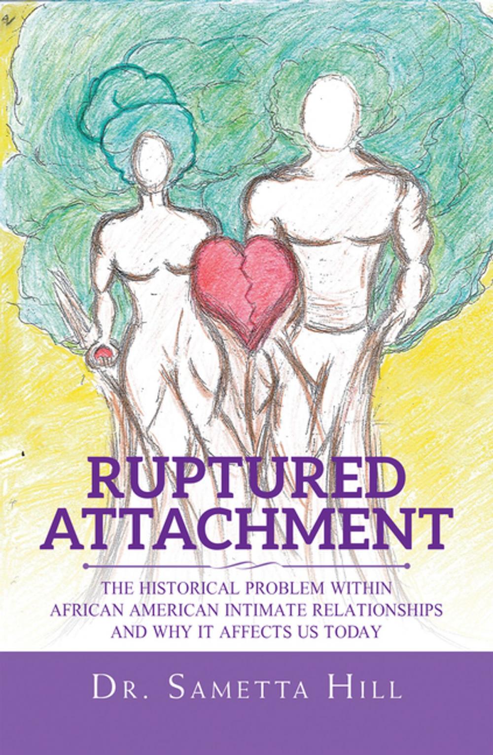 Big bigCover of Ruptured Attachment