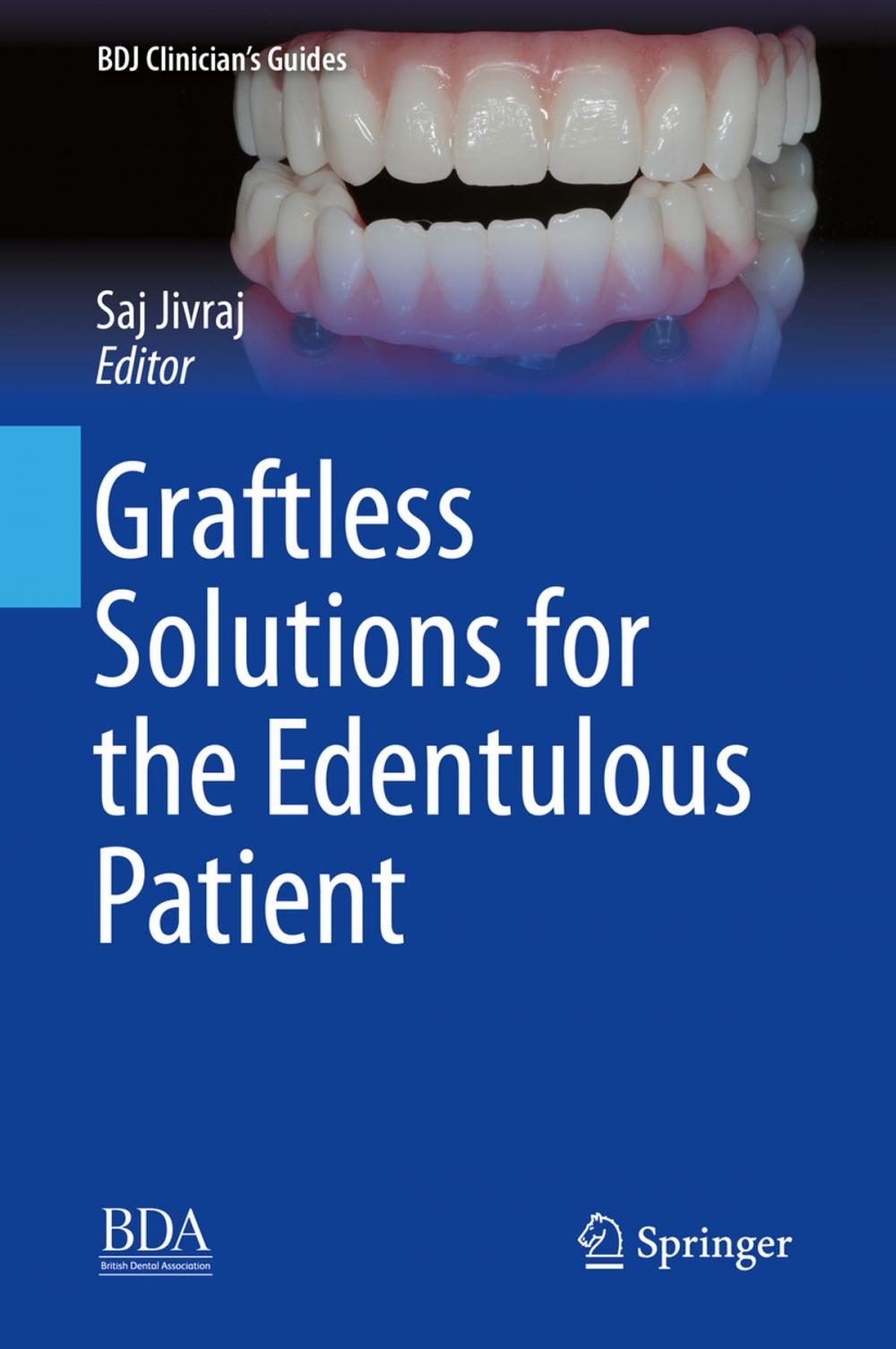 Big bigCover of Graftless Solutions for the Edentulous Patient