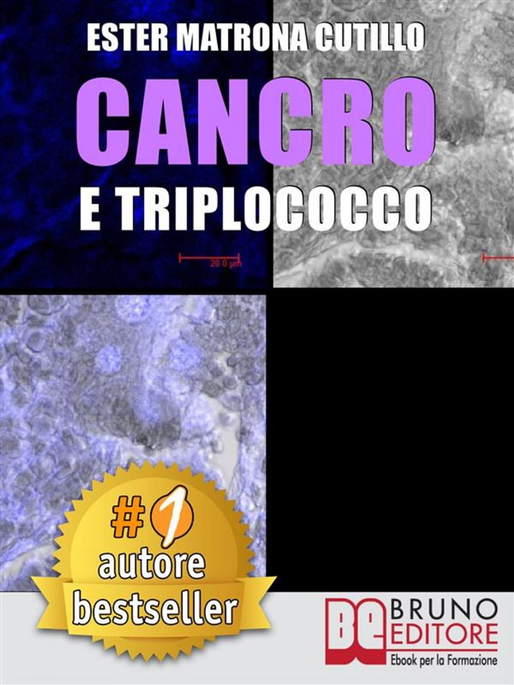 Big bigCover of Cancro e Triplococco