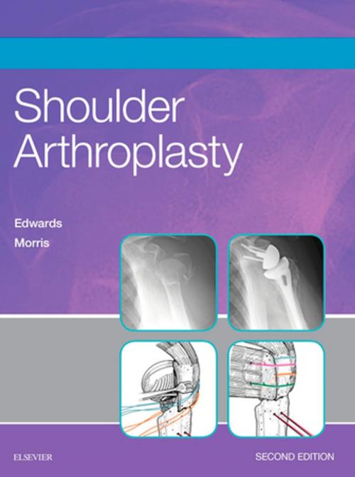 Cover of the book Shoulder Arthroplasty E-Book by T. Bradley Edwards, MD, Brent J. Morris, MD, Elsevier Health Sciences