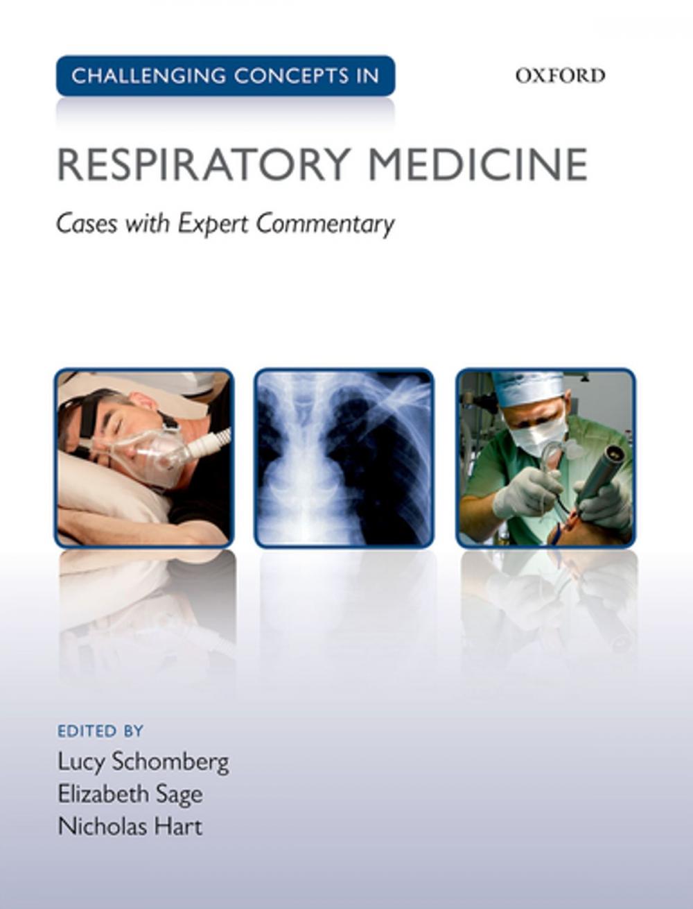 Big bigCover of Challenging Concepts in Respiratory Medicine