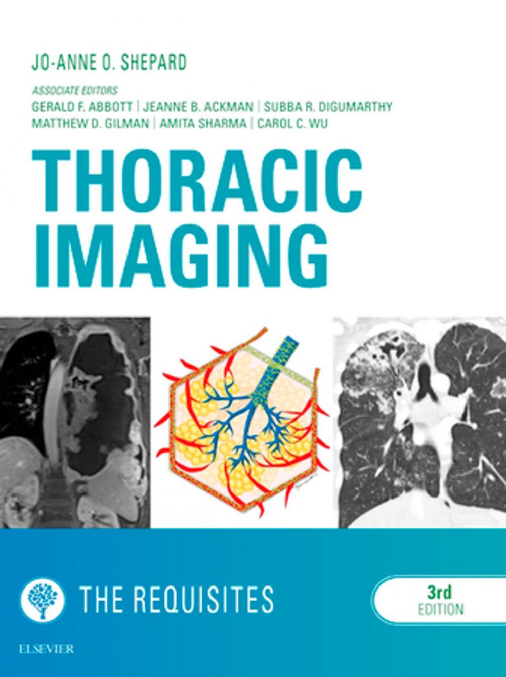 Big bigCover of Thoracic Imaging The Requisites E-Book