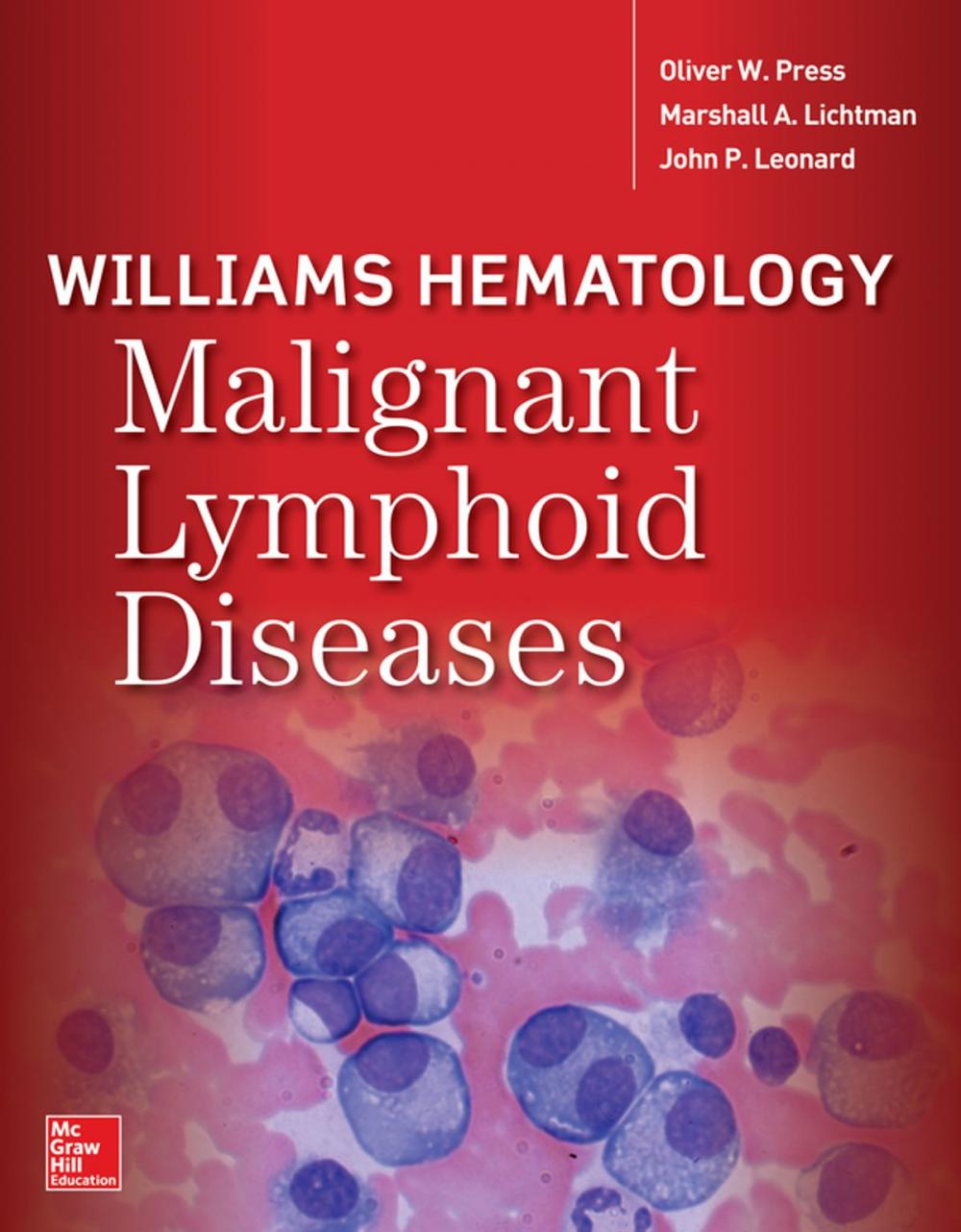 Big bigCover of Williams Hematology Malignant Lymphoid Diseases