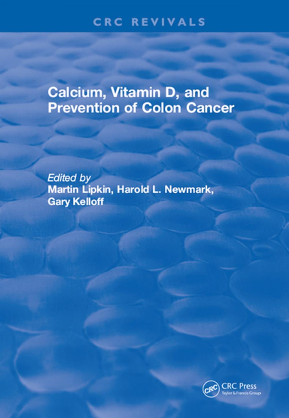 Big bigCover of Calcium, Vitamin D, and Prevention of Colon Cancer