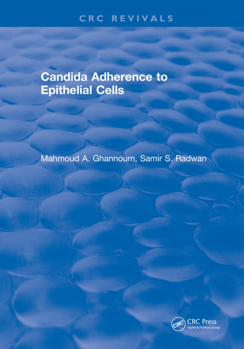 Big bigCover of Candida Adherence to Epithelial Cells