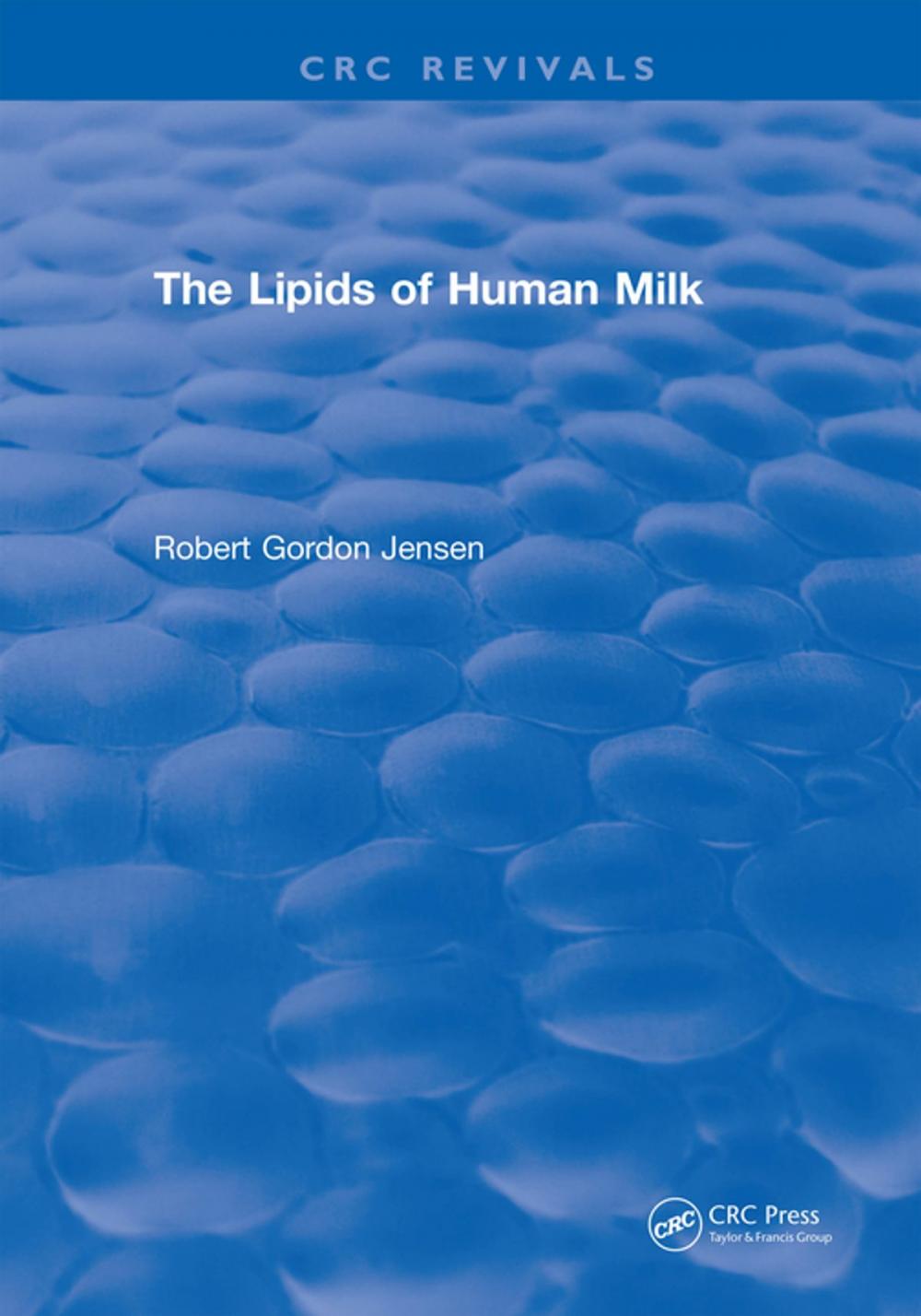 Big bigCover of The Lipids of Human Milk