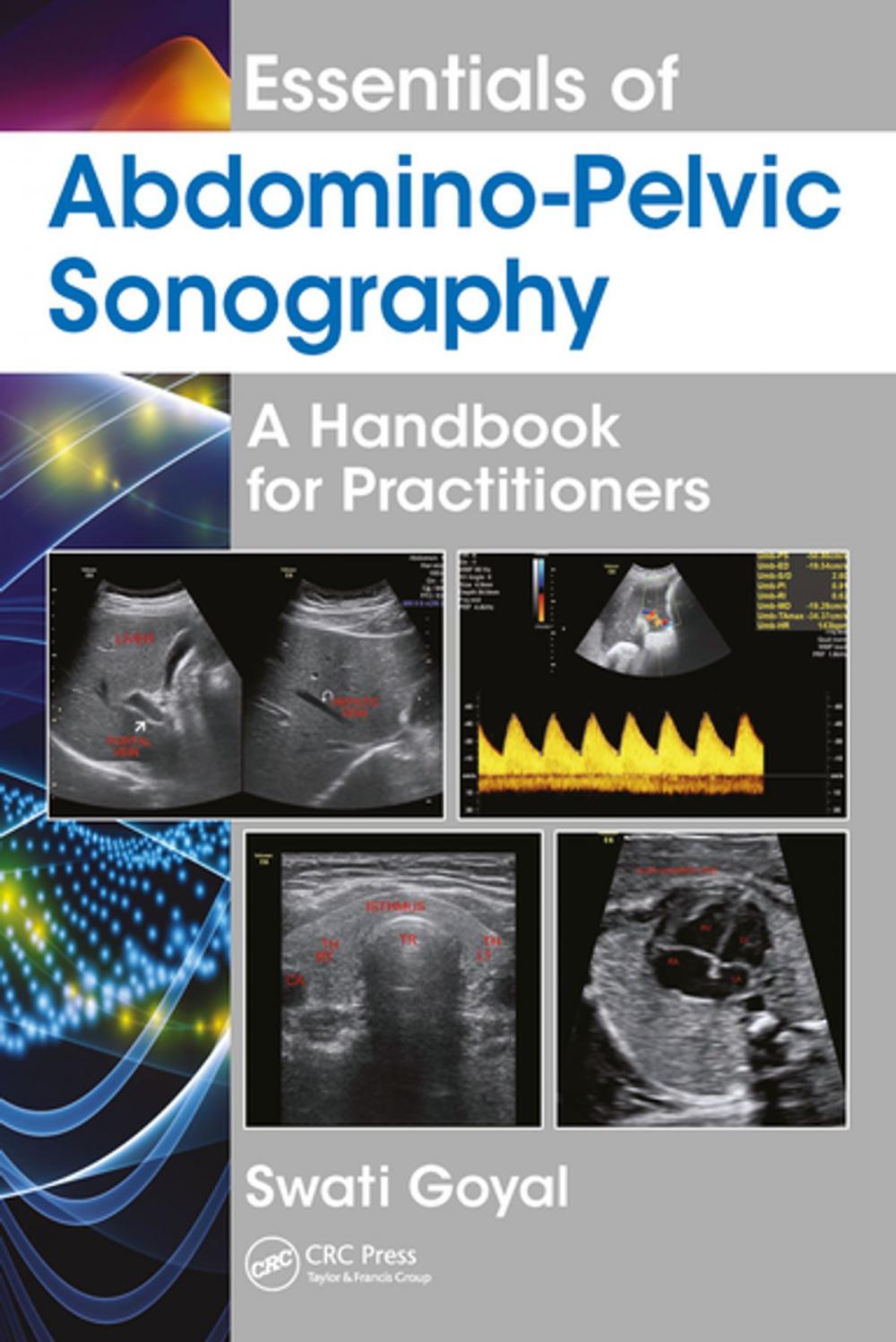 Big bigCover of Essentials of Abdomino-Pelvic Sonography