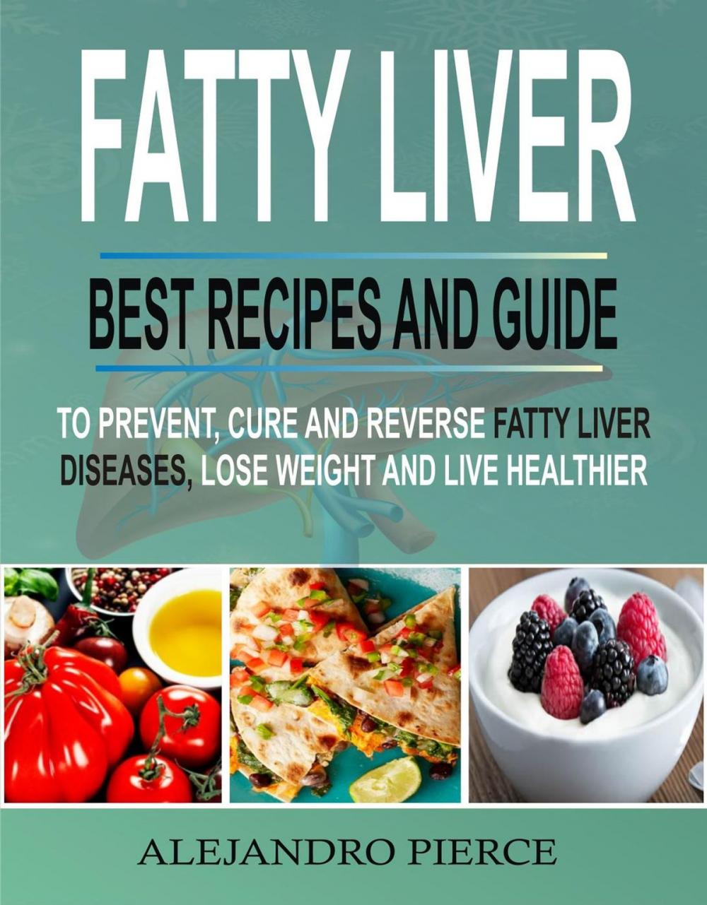 Big bigCover of Fatty Liver: Best Recipes And Guide To Prevent, Cure And Reverse Fatty Liver Diseases, Lose Weight & Live Healthier