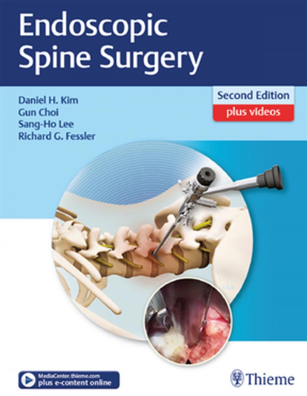 Big bigCover of Endoscopic Spine Surgery