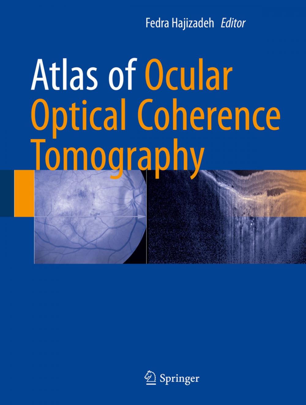 Big bigCover of Atlas of Ocular Optical Coherence Tomography