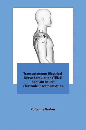 bigCover of the book Transcutaneous Electrical Nerve Stimulation (TENS) For Pain Relief: Electrode Placement Atlas by 