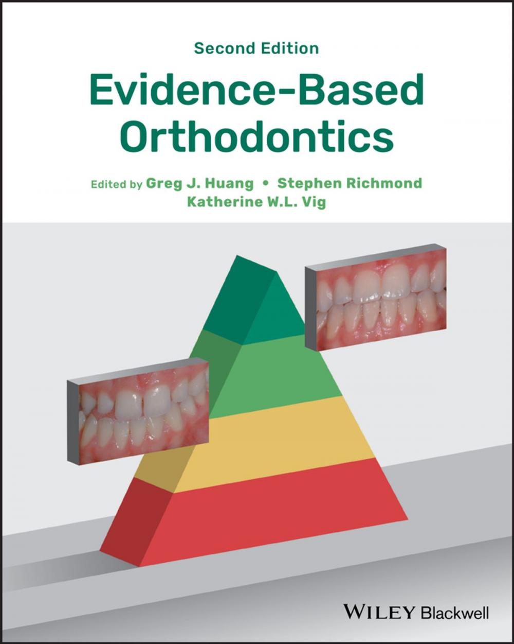 Big bigCover of Evidence-Based Orthodontics