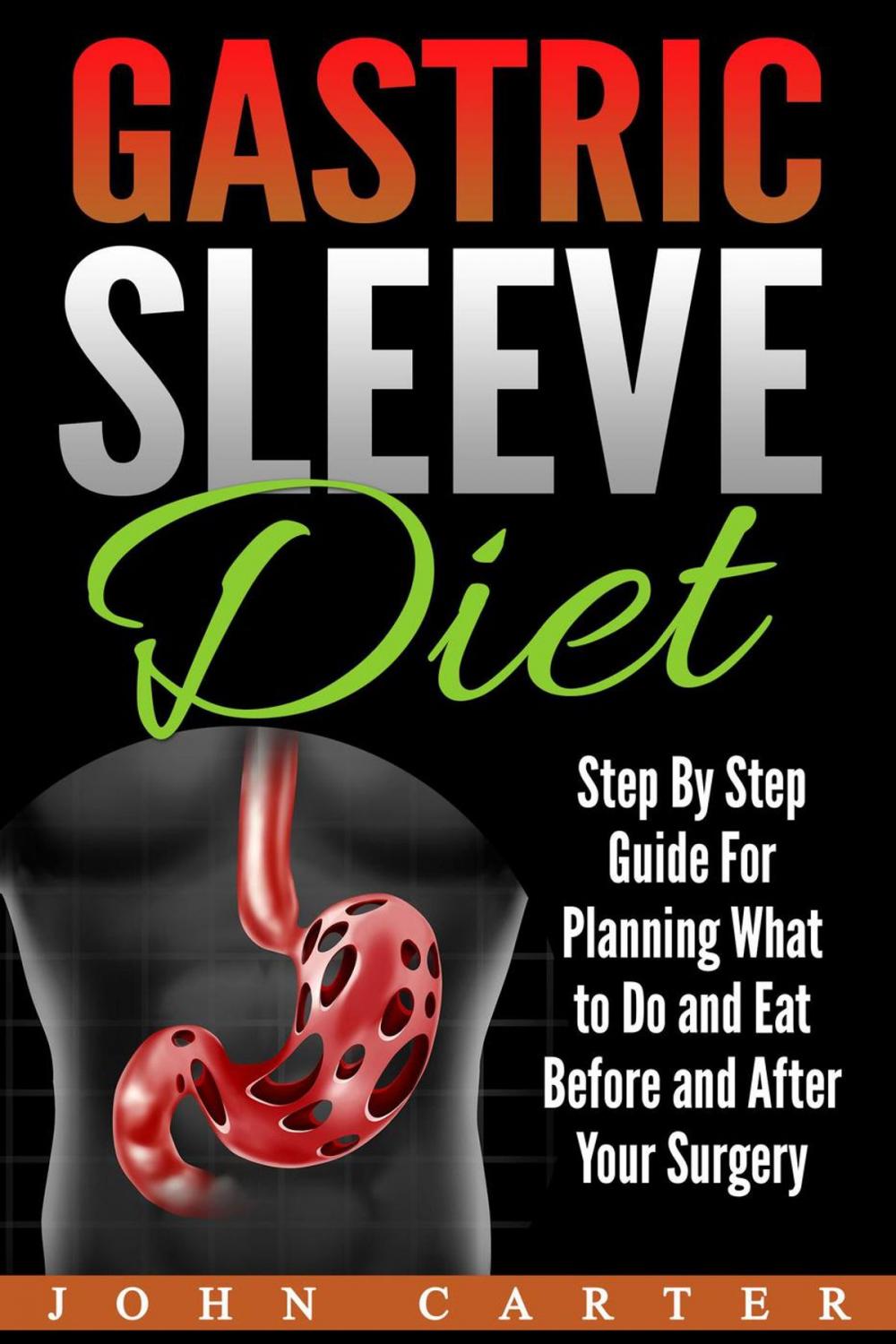 Big bigCover of Gastric Sleeve Diet: Step By Step Guide For Planning What to Do and Eat Before and After Your Surgery