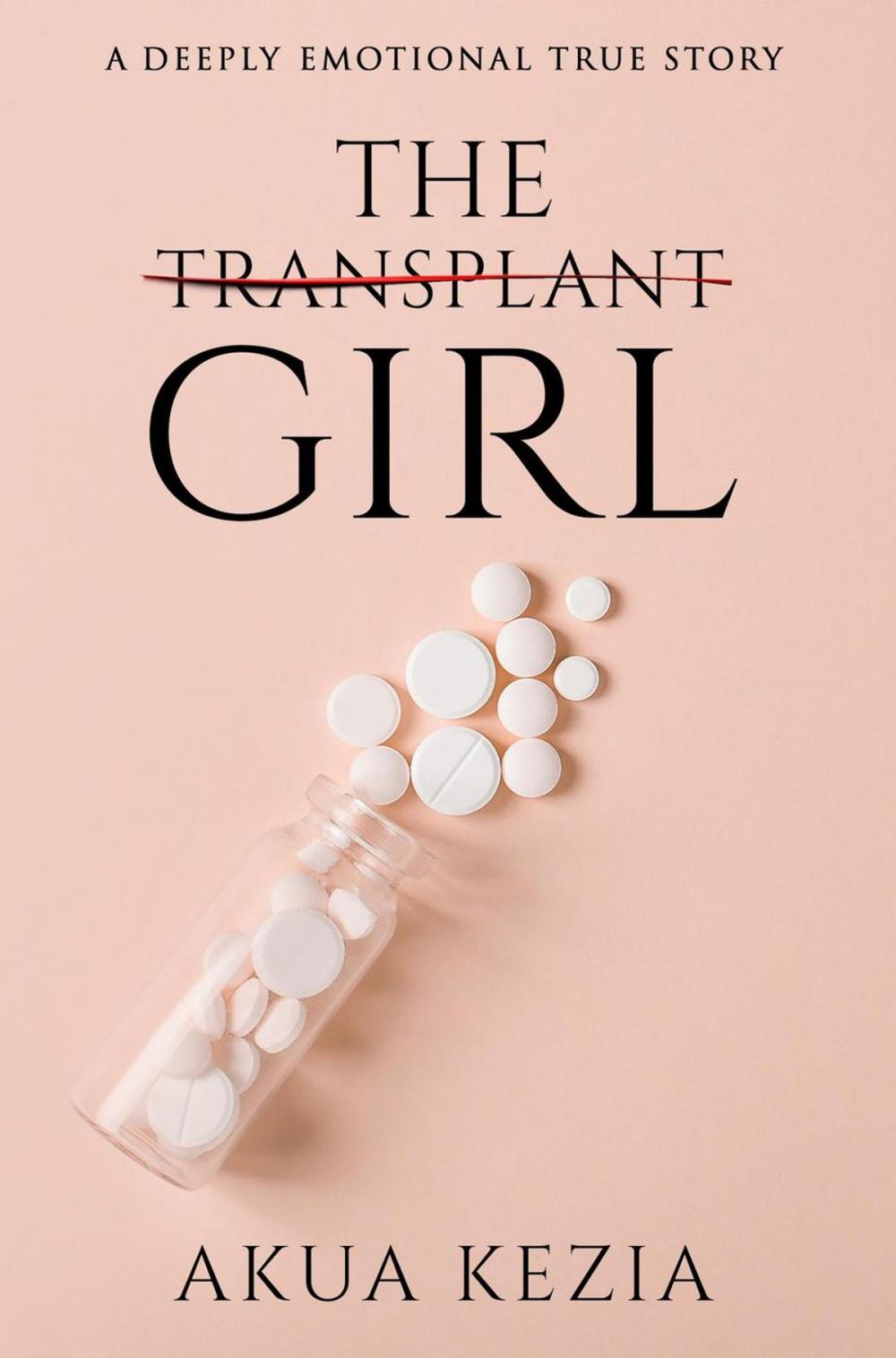 Big bigCover of The Transplant Girl