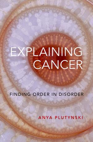 Cover of the book Explaining Cancer by Eric Chafe