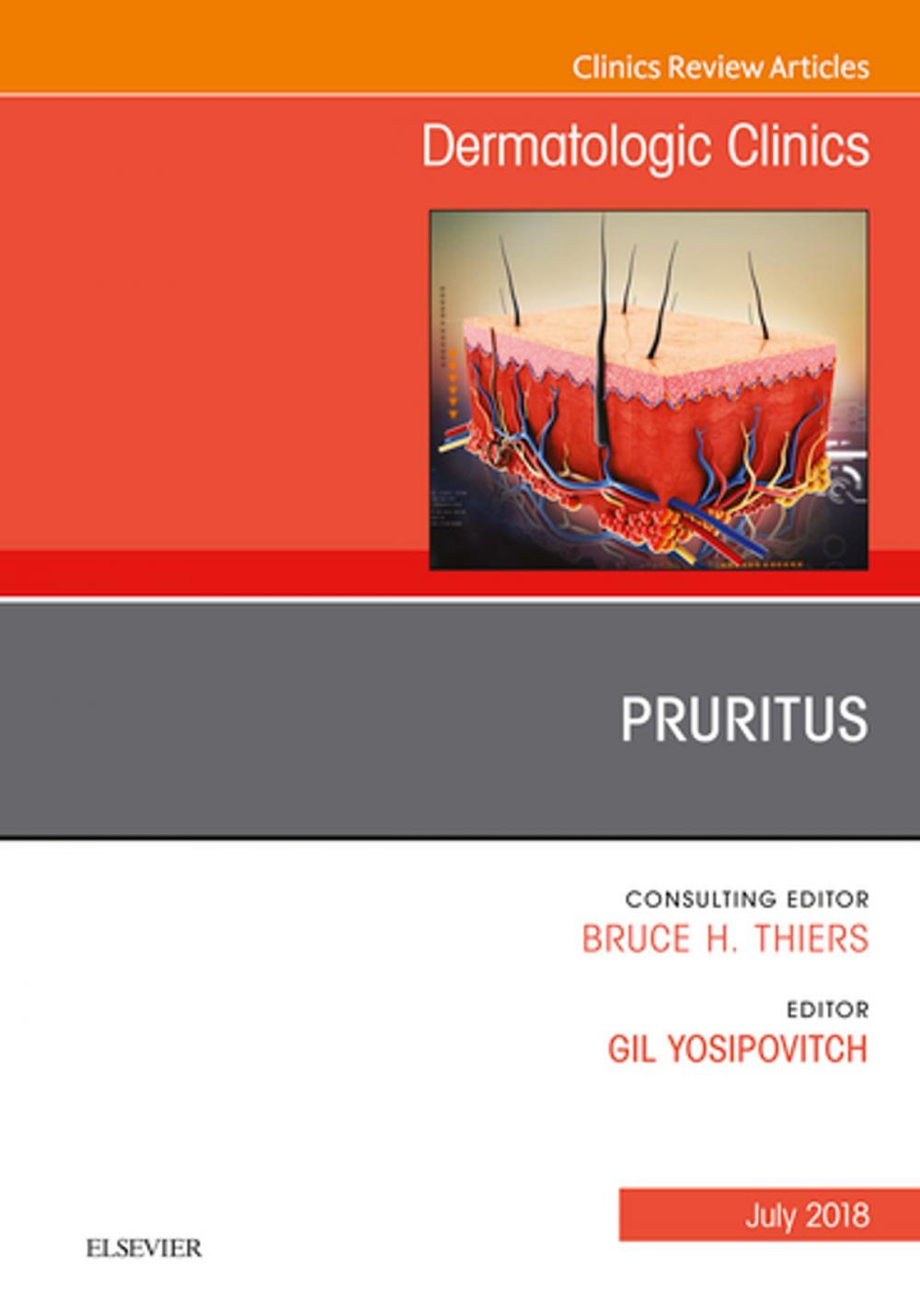 Big bigCover of Pruritus, An Issue of Dermatologic Clinics, E-Book