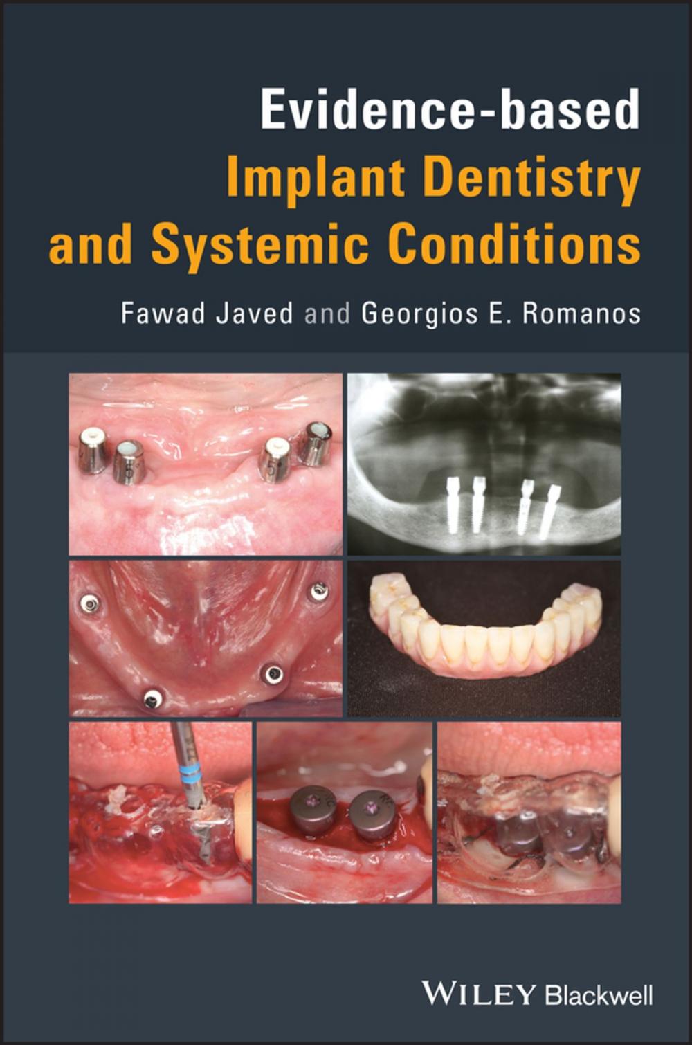 Big bigCover of Evidence-based Implant Dentistry and Systemic Conditions