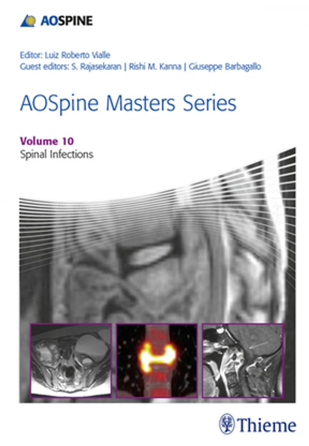 Big bigCover of AOSpine Masters Series, Volume 10: Spinal Infections