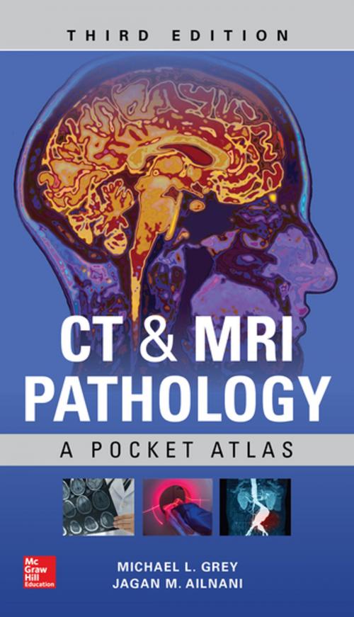 Cover of the book CT & MRI Pathology: A Pocket Atlas, Third Edition by Michael L Grey, Jagan Mohan Ailinani, McGraw-Hill Education