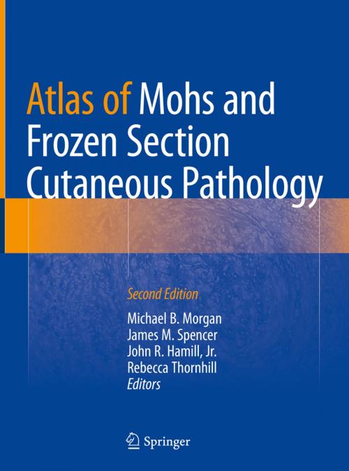 Cover of the book Atlas of Mohs and Frozen Section Cutaneous Pathology by , Springer International Publishing